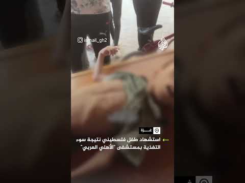 ضحية جديدة لحرب التجويع في غزة استشهاد الطفل عزام الشاعر نتيجة سوء التغذية