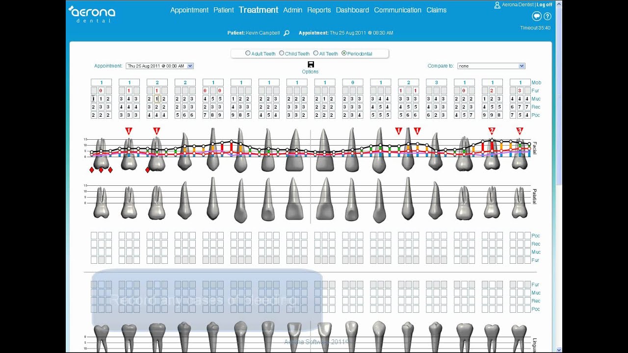 Dental Periodontal Chart