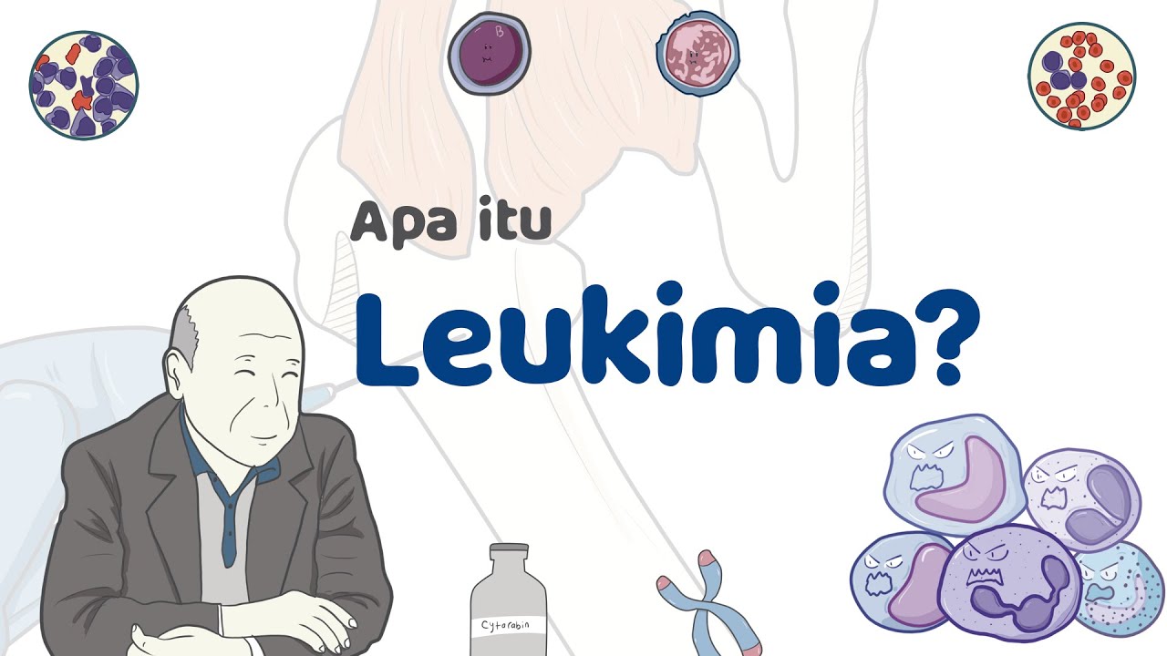 Apa Itu Leukimia Yuk Kenali Tandanya YouTube
