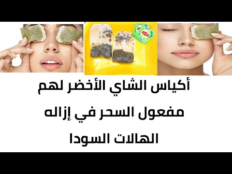 لازاله الهالات السودا عليك استخدام كمادات الشاي الأخضر لهم مفعول السحر
