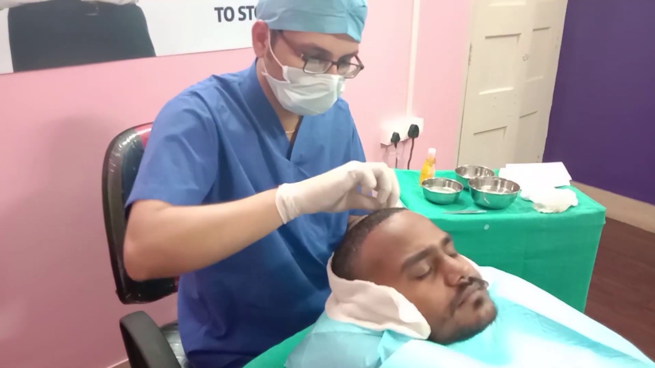 First Head Wash after Hair Transplant by Dr. Vikas Chouhan | Hair Wash Process & Patient's review