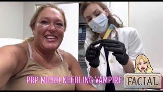 Vampire facial: platelet rich plasma (PRP)| Micro-needling