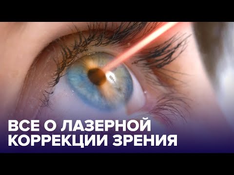 Что нужно знать о ЛАЗЕРНОЙ КОРРЕКЦИИ ЗРЕНИЯ?