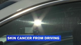 Some seeing skin aging, cancer from driving
