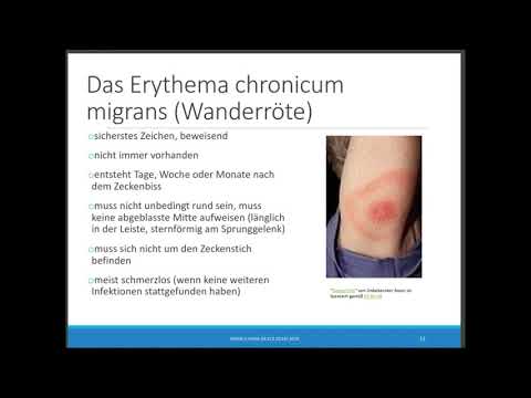 2. Teil Borreliose