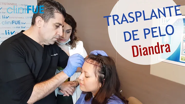 La decisin de Diandra sobre su TRASPLANTE DE PELO ...