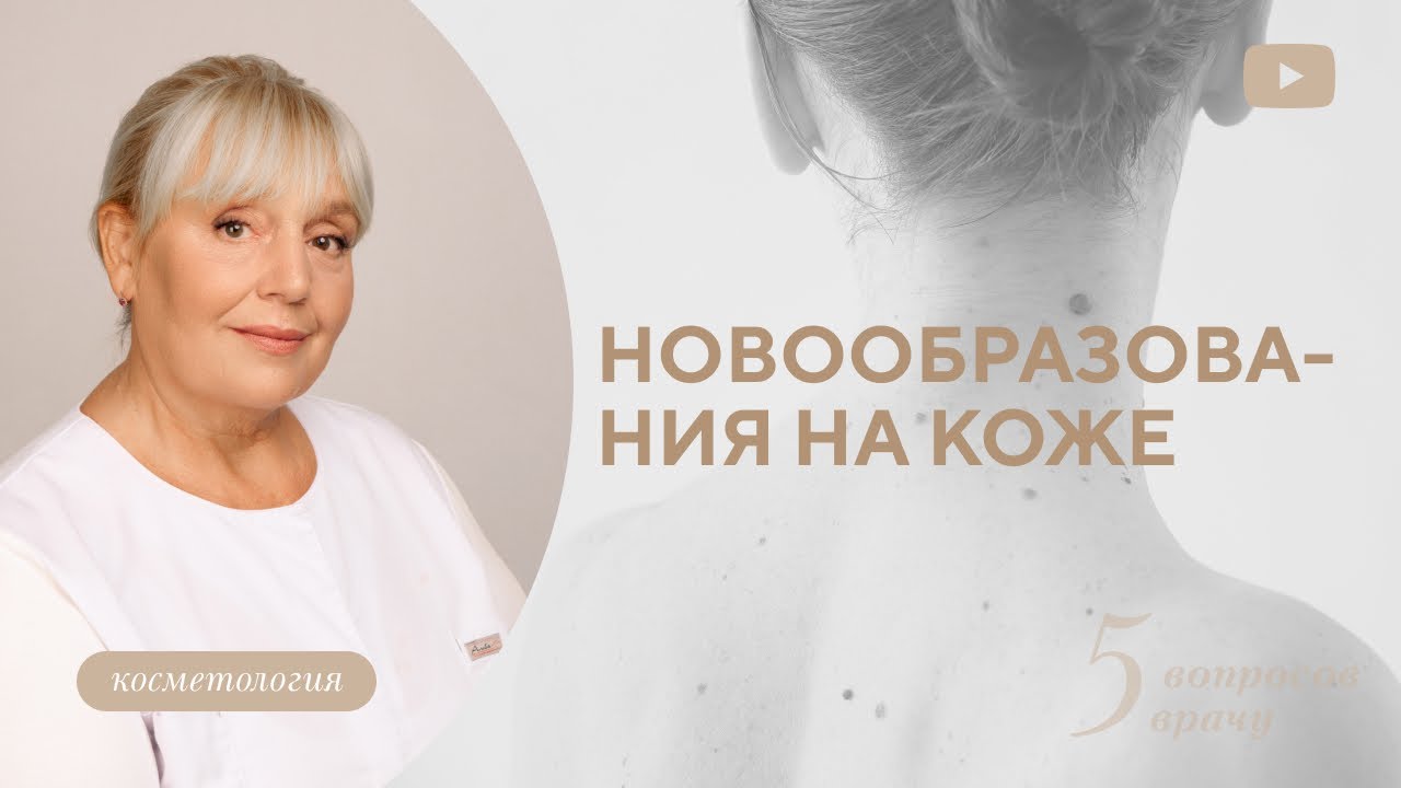 Надо ли удалять родинки? Какие родинки опасные?