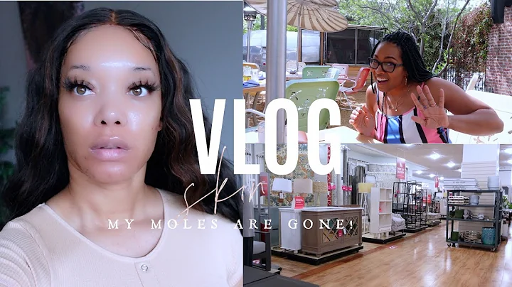 WEEKLY VLOG | My Moles Are Gone + Meeting Peypals + Home Decor + He Brought Protection