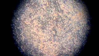 Beating Cardiac Cells