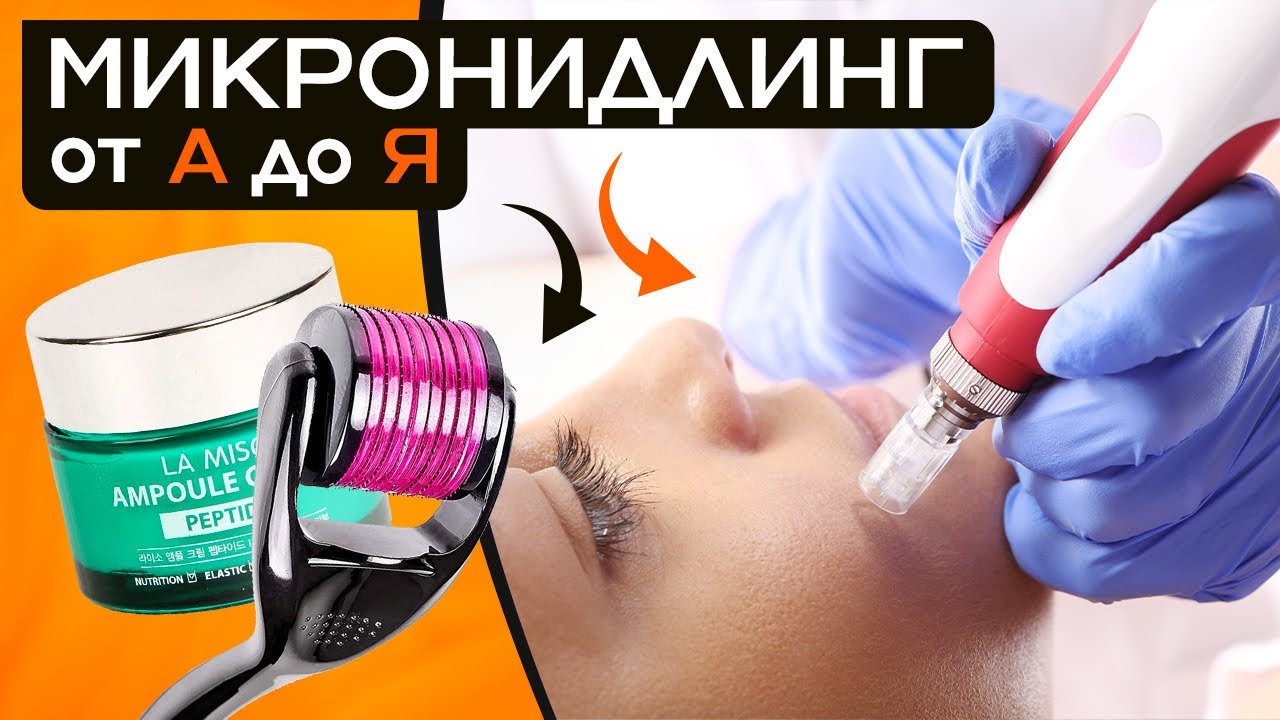 Эта процедура ВЕРНЕТ МОЛОДОСТЬ! Фракционная мезотерапия для ЗДОРОВЬЯ кожи