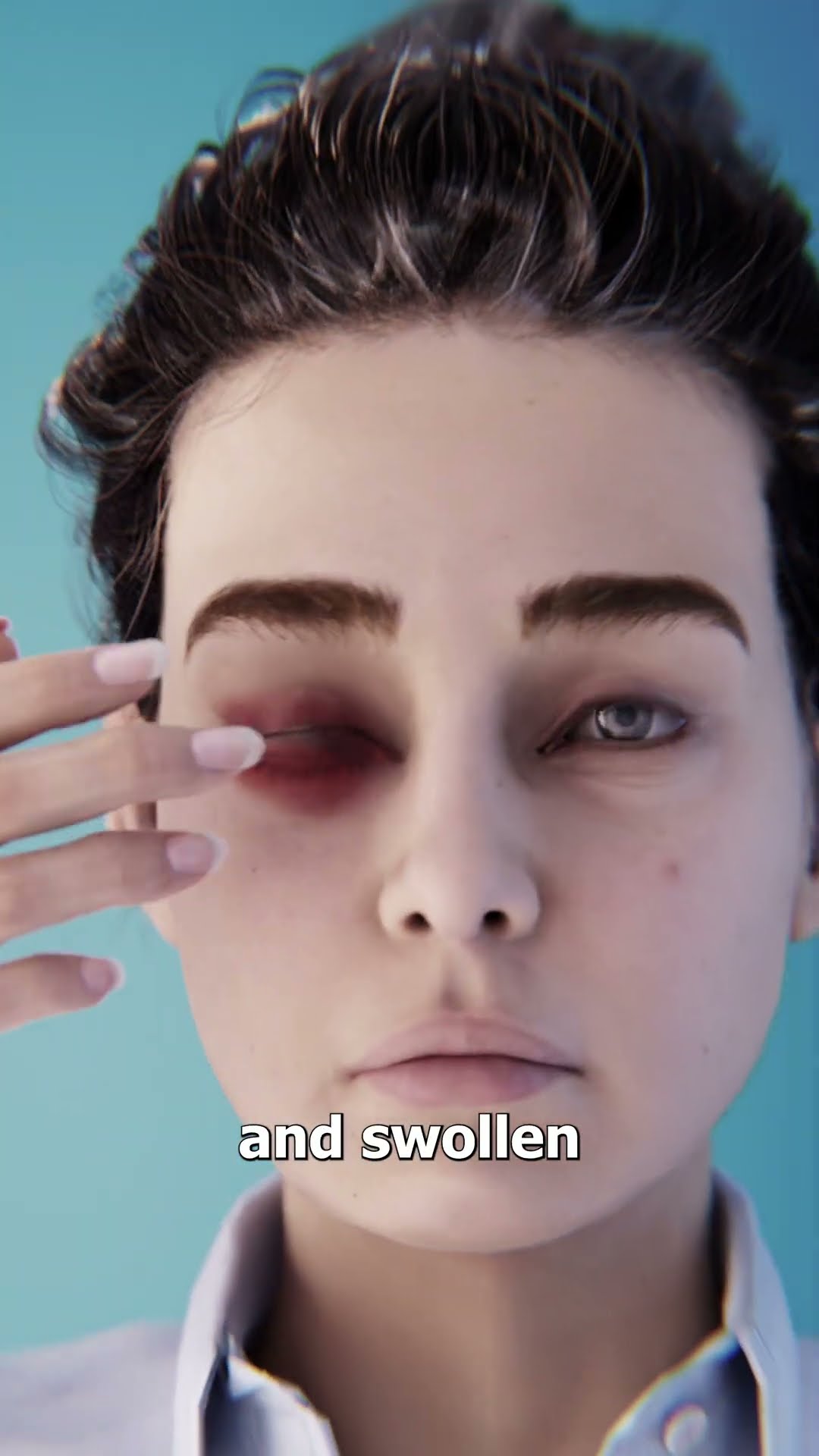 Bees In A Woman’s Eye ?