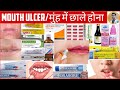     mouth ulcer treatment    treatment of mouth ulcer