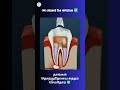 Root Canal = Pain Relief + Tooth Protection