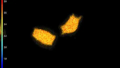 YFP Transfected Cells Fluorescence Lifetime