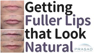 How to Get Fuller Lips that Still Look Natural, and Minimize Temporary Swelling and Bruising