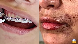 Most Extreme Beauty Treatments 2022 Best Smart and Helpful Beauty Hacks | Virtual Beauty