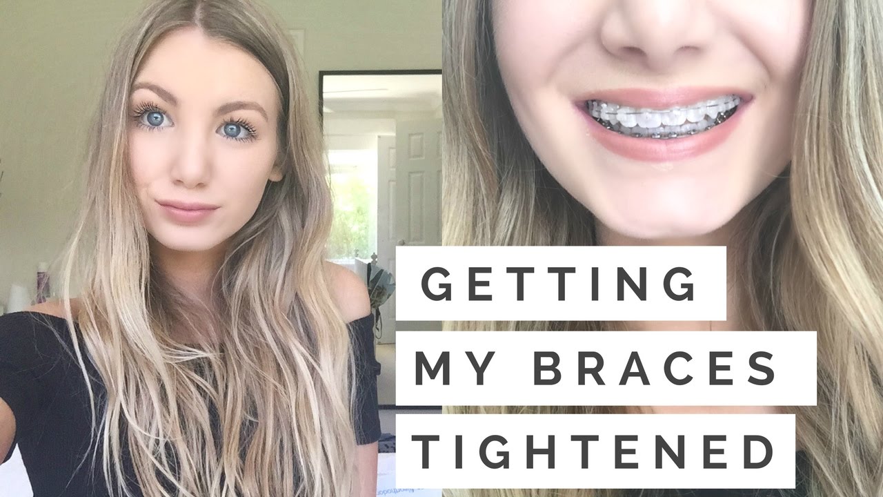 What Does Brace Tightening Do?