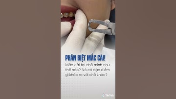 Niềng Răng: Phân Biệt Mắc Cài Chính Hãng và Mắc Cài P.h.a.k.e | Niềng Răng Mắc Cài