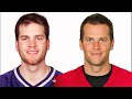 Tom Brady Got PLASTIC SURGERY? - Hair Transplant Claim Addressed