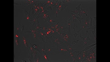 pHrodo Red LDL time lapse uptake study