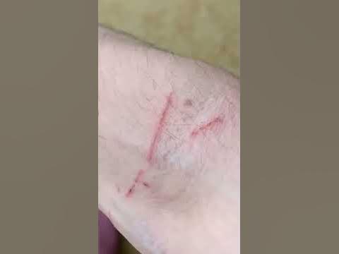 Спасаю Кайто!😱 - YouTube