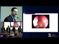 Nasal Polyps: Is there Any Help in Sight - New Advances in Treatment for This Disease