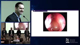 Nasal Polyps: Is there Any Help in Sight - New Advances in Treatment for This Disease