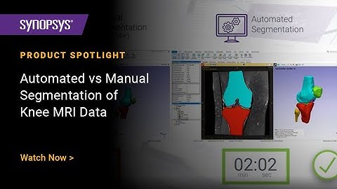 Automated vs Manual Segmentation of Knee MRI Data in Simpleware Software