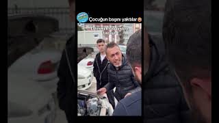 Çocuğun Başını Yaktılar