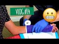 Getting A Cast Removed | Vlog #14