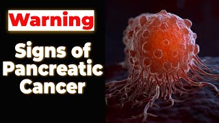 6 Warning Signs of Pancreatic Cancer