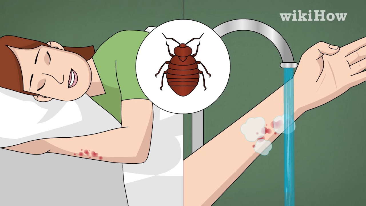 Bed Bug Infestation Treatment