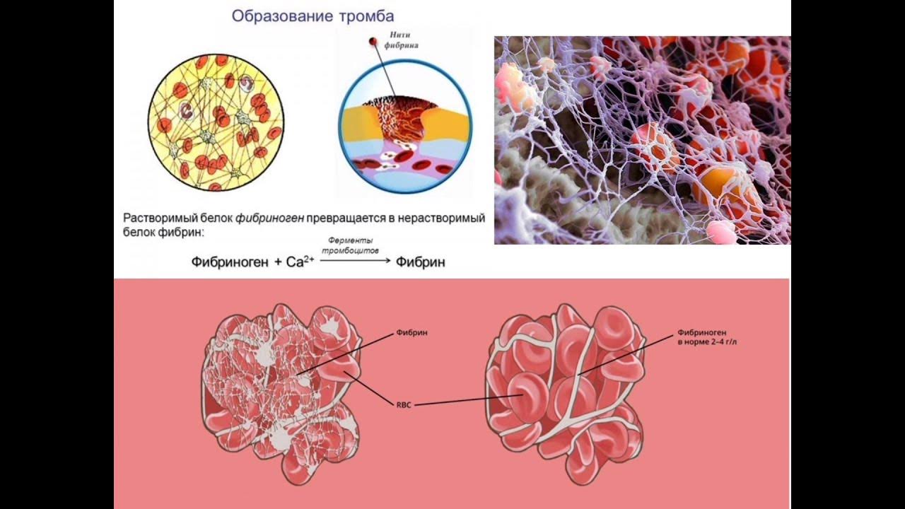 Возвращает в кровь белки. ВМК свертывание крови. Свертывание крови тест ЕГЭ биология. Свёртывание крови рисунок по биологии. Белок крови моллюсков.