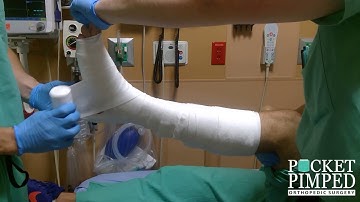 How to Apply an AO Splint