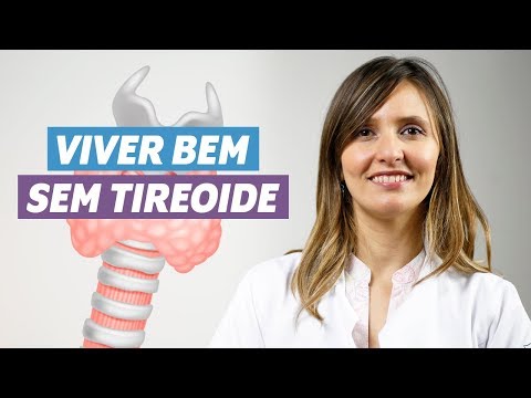 Vídeo: Quanto Tempo Uma Pessoa Pode Viver Sem Cabeça? - Visão Alternativa