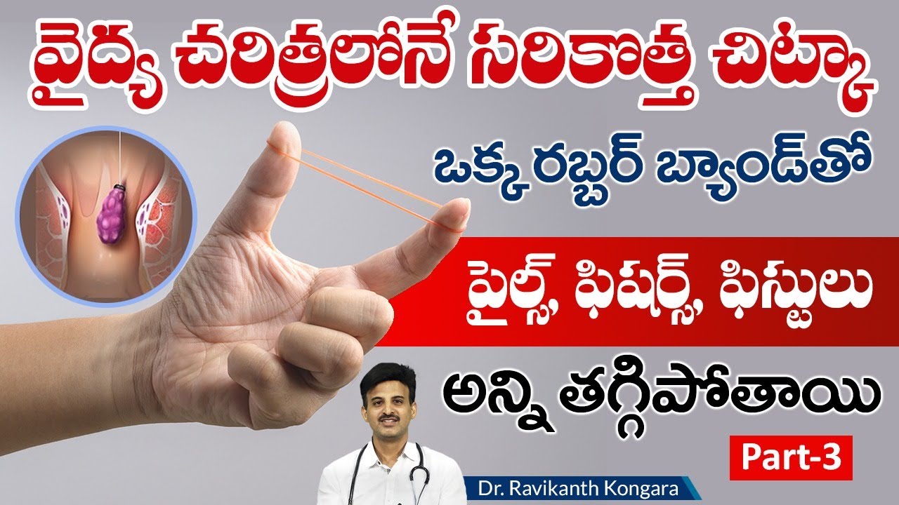 Solution for Piles | Fissures | Fistula | Causes for Piles | Constipation | Dr. Ravikanth Kongara