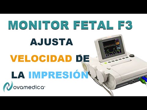 Vídeo: Una Pantalla Genética Avanzada Con Un Ratón Indicador De Axón Talamocortical Produce Mutantes De Neurodesarrollo Novedosos Y Un Fenotipo Mutante Emx2 Distinto