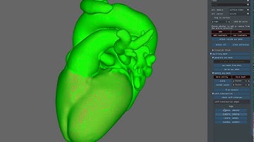 fixing self-intersections of surfaces