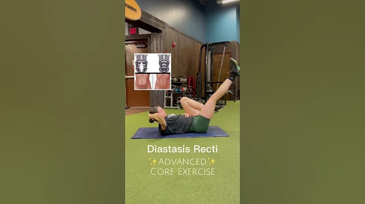 Advanced diastasis recti core exercise  #diastasis...