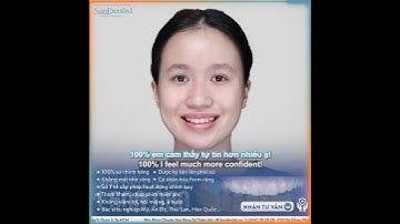 Hành trình làm đẹp qua phương pháp phủ sứ thẩm mỹ | San Dentist