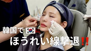 【美容医療】韓国でほうれい線なくして老け顔解消してきた！✨