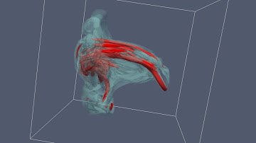 Collision of a magnetic tube with a vortex ring in MHD