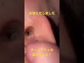 【閲覧注意】【耳掃除】やっと取れました！デケェ耳垢。2023新春　#asmr #clean #ear #wax #耳垢 #耳かき #shorts