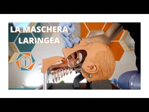 Video: Confronto Tra Tecniche Di Inserimento Video Guidate Dal Videolaryngoscope E Standard Delle Vie Respiratorie Con Maschera Laringea ProSeal ™: Uno Studio Prospettico Randomizzato