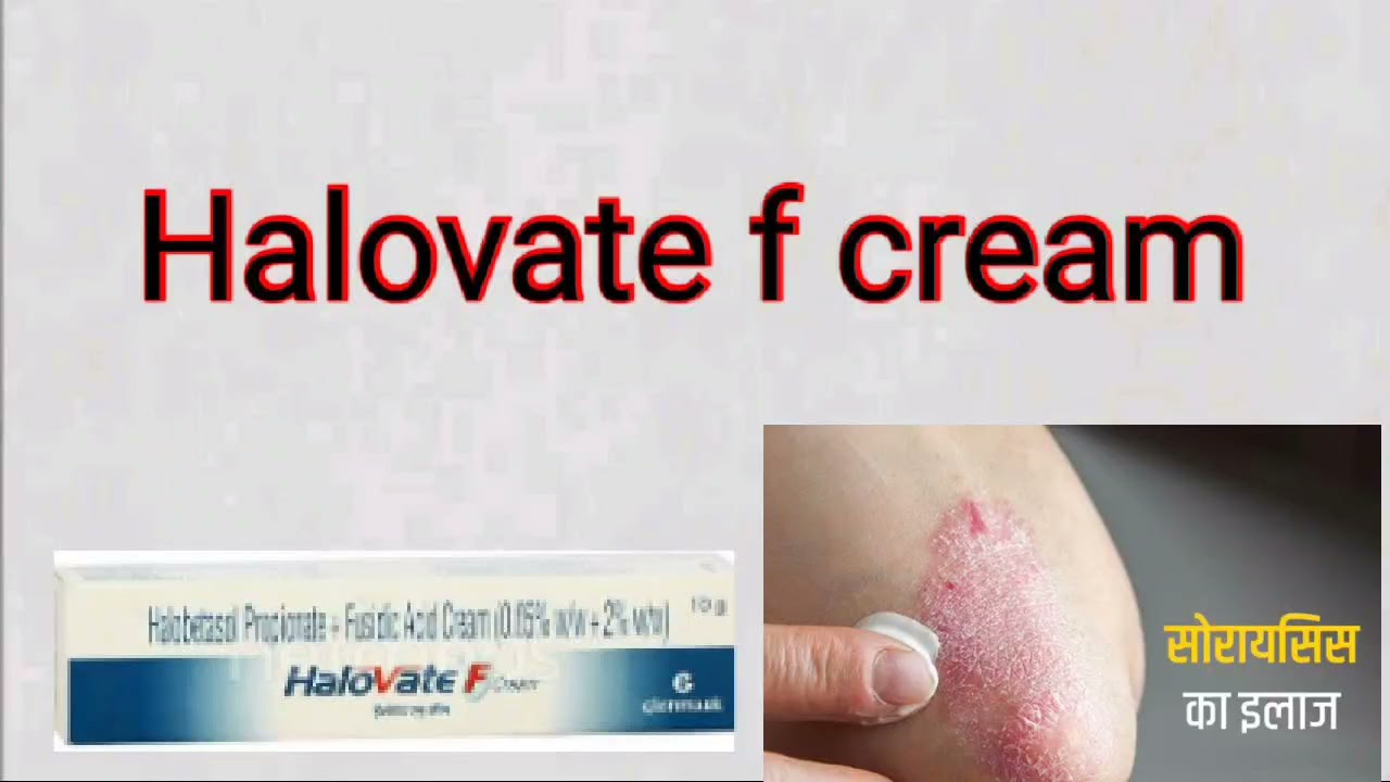 Omifin Plus Cream Uses In Hindi Halovate f cream uses in Hindi - YouTube