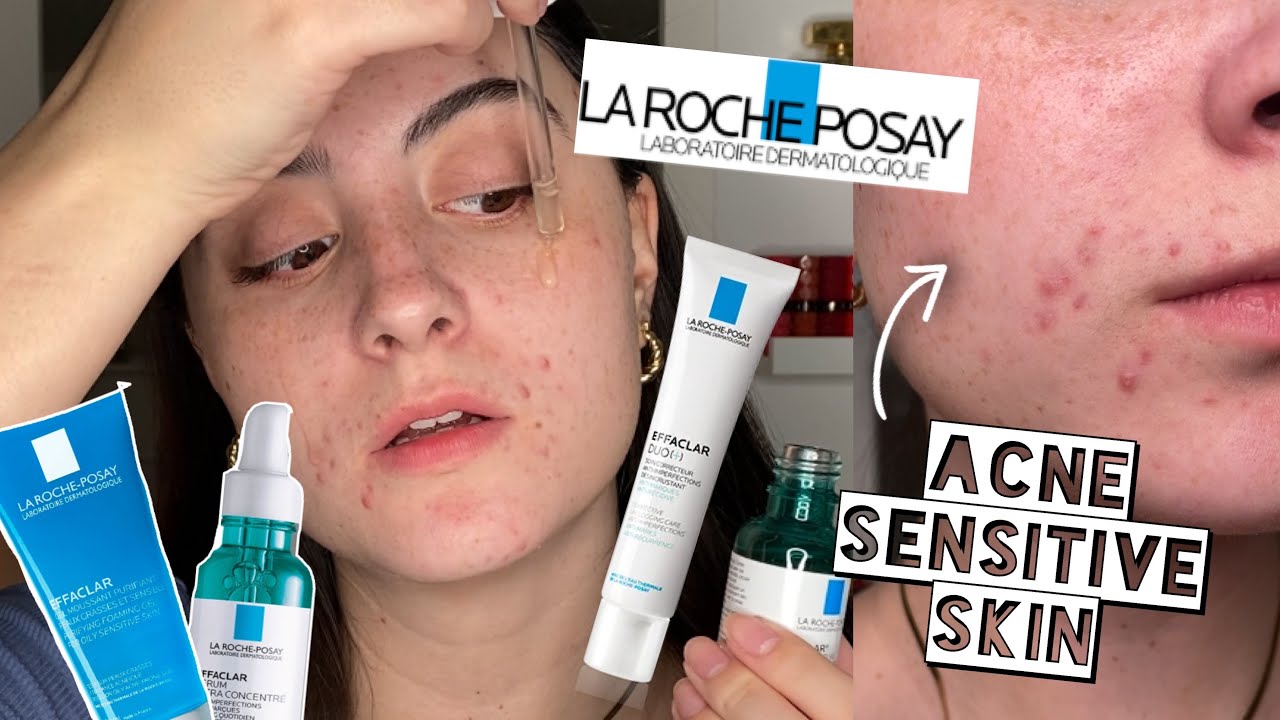 TESTING LA ROCHE EFFECLAR SKINCARE ROUTINE ON ACNE, DRY SKIN 2 WEEKS - YouTube