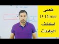 ما هو فحص D-Dimer وما الفائدة منه ؟