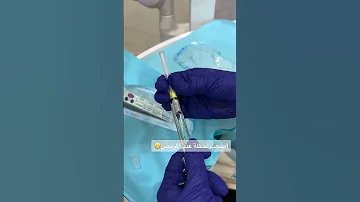 أصعب لحظة عن المريض هي الأبرة دكتور اسنان دكتور طبيب 