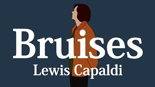 【和訳】Lewis Capaldi - Bruises