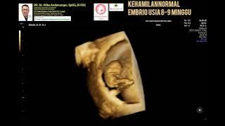 Hamil 8-9 minggu janin normal